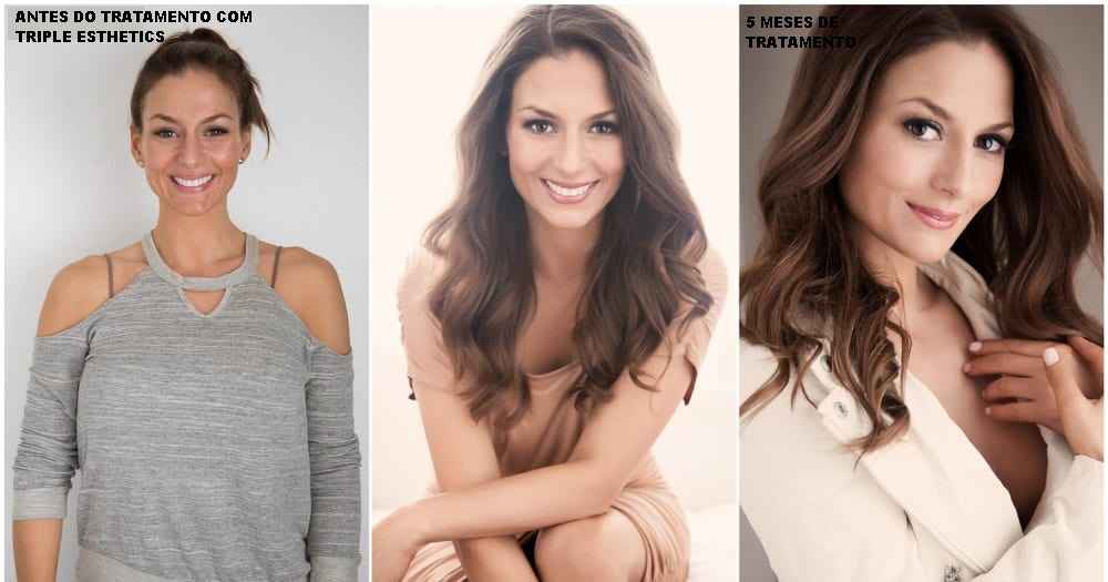 Image Title My Image